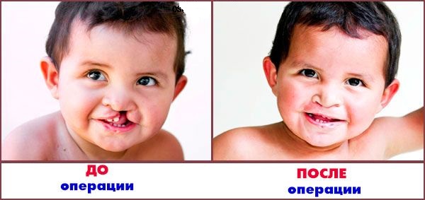 После операции
