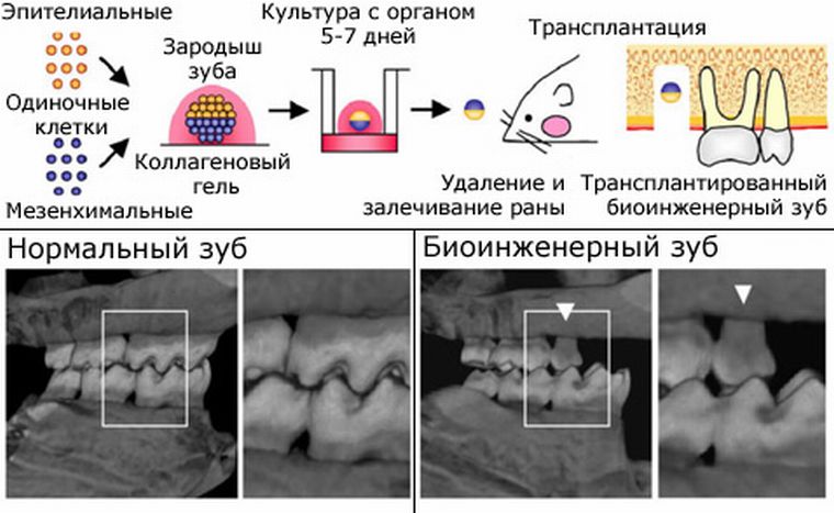выращивание зубов из стволовых клеток