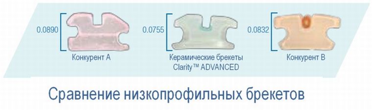 Clarity брекеты