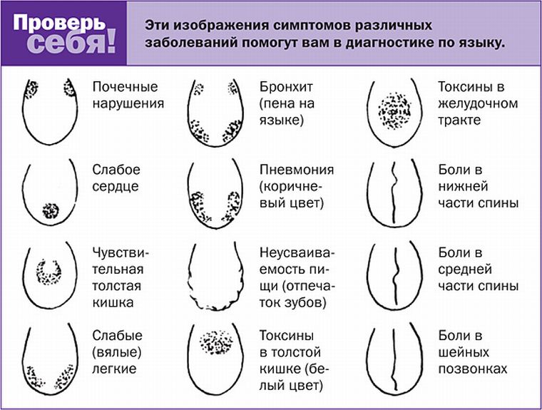 диагноз по языке