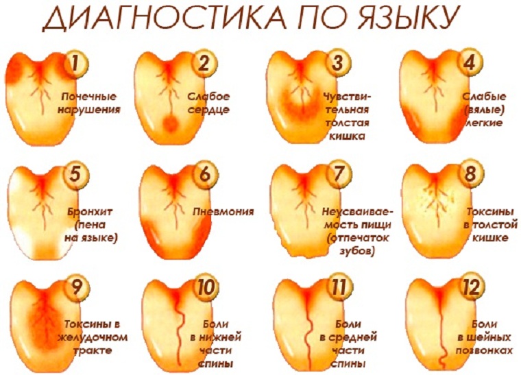 Диагностика по цвету языка