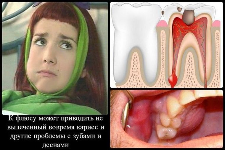 причины зубного флюса