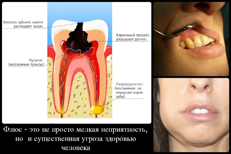 флюс