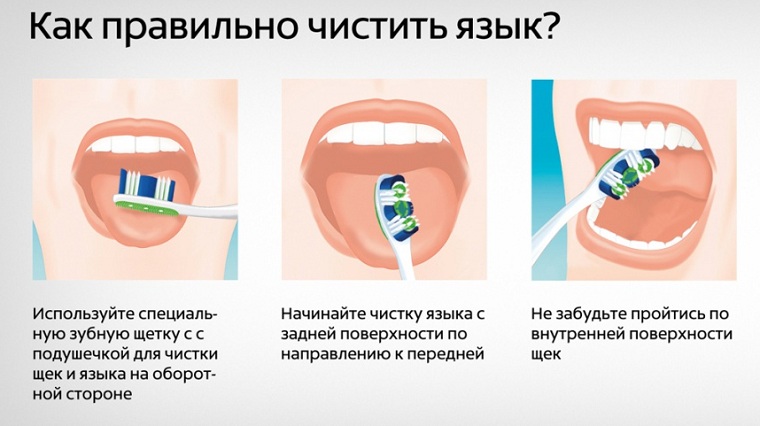Как чистить язык