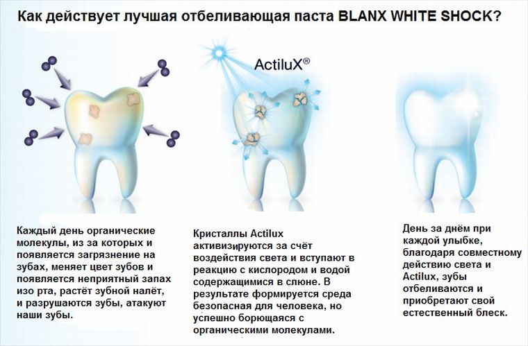 Как работает технология ActiluX