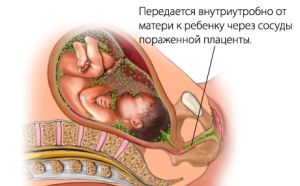 передача сифилиса