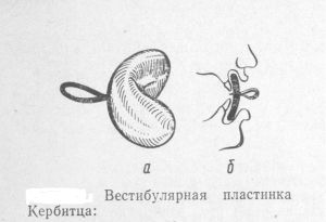 Устройство Кербитца