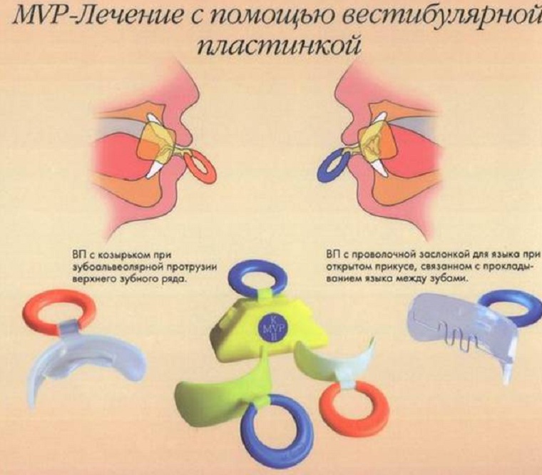 Как пользоваться пластинкой для коррекции