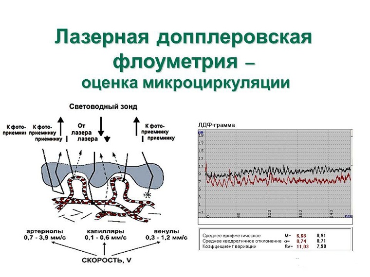 Лазерная допплеровская флоуметрия