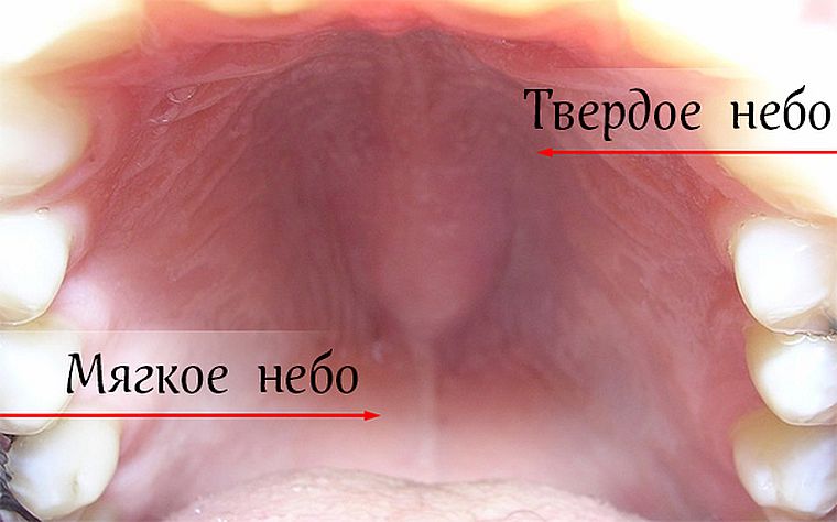 строение нёба