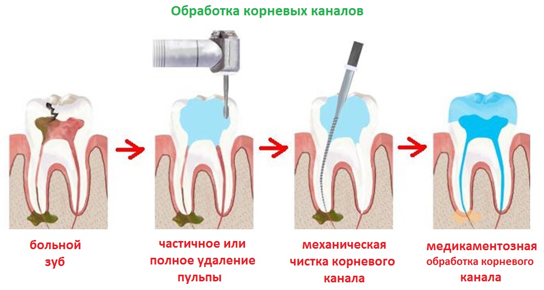 обработка каналов
