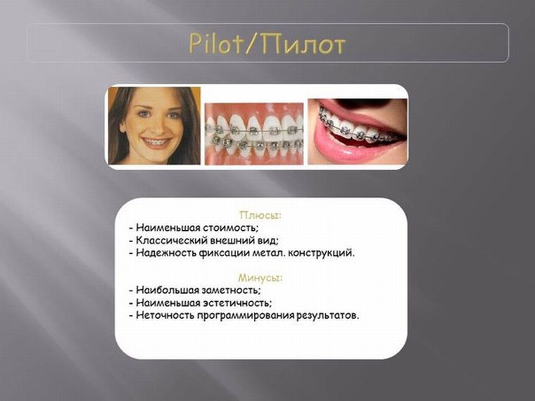 Пилот брекеты