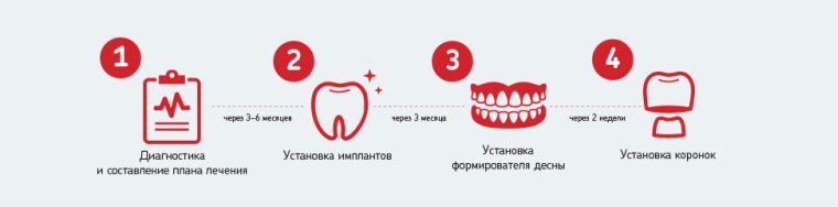 Этапы протезирования