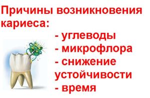 причины кариеса