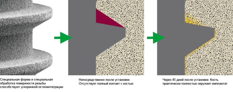 Процесс приживления занимает 45-60 дней