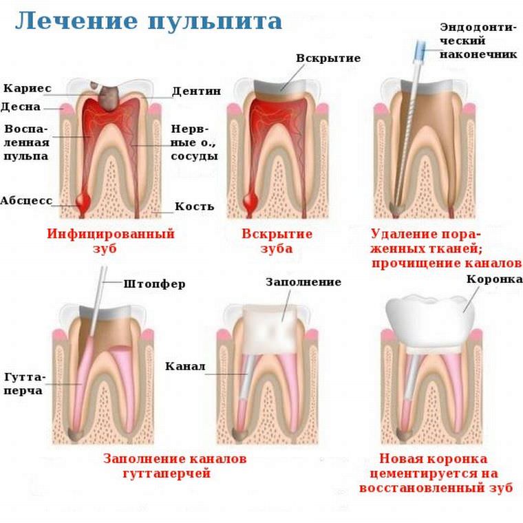 Лечение
