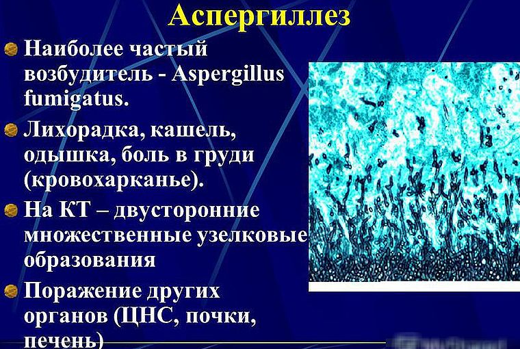 аспергиллез