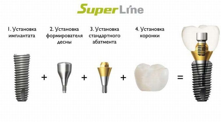 Импланты Super-Line