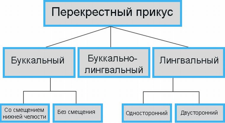 Буккальный и лингвальный перекрестный прикус