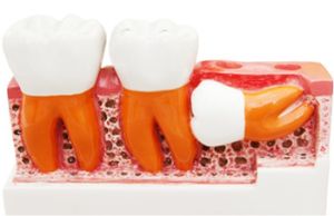 зубы аномальные